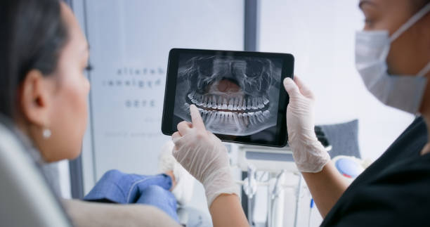 Licensed Teeth Whitening service in Tulia, TX - Smile Center Dentistry